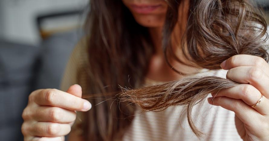 Young Woman Has Hair Loss Problem