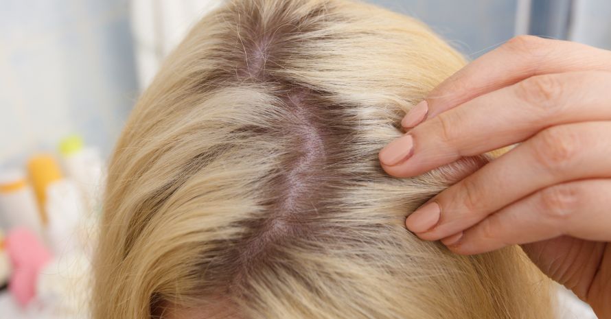 Woman showing blonde hair roots